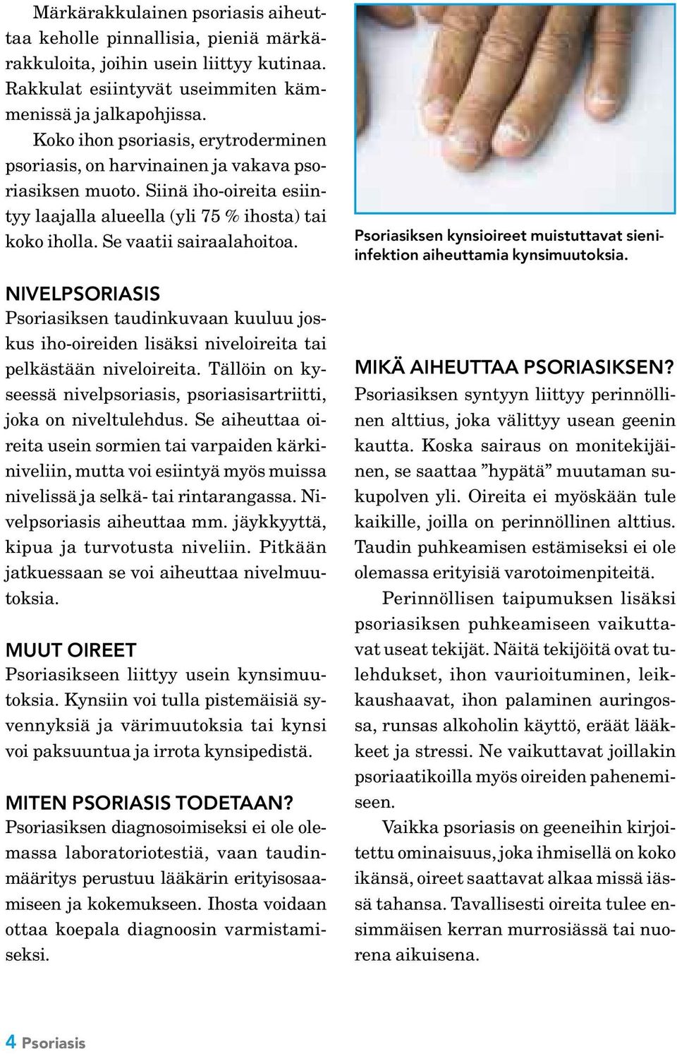 NIVELPSORIASIS Psoriasiksen taudinkuvaan kuuluu joskus iho-oireiden lisäksi niveloireita tai pelkästään niveloireita. Tällöin on kyseessä nivelpsoriasis, psoriasisartriitti, joka on niveltulehdus.