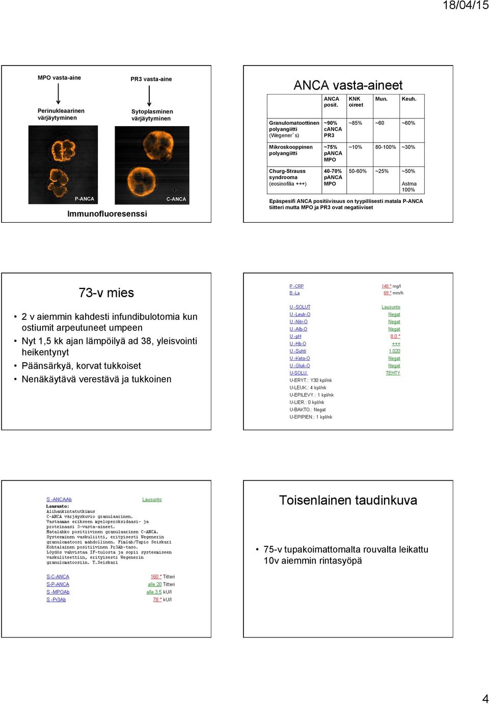 ~85% ~60 ~60% Mikroskooppinen polyangiitti Churg-Strauss syndrooma (eosinofilia +++) ~75% panca MPO 40-70% panca MPO ~10% 80-100% ~30% 50-60% ~25% ~50% Astma 100% Immunofluoresenssi Epäspesifi