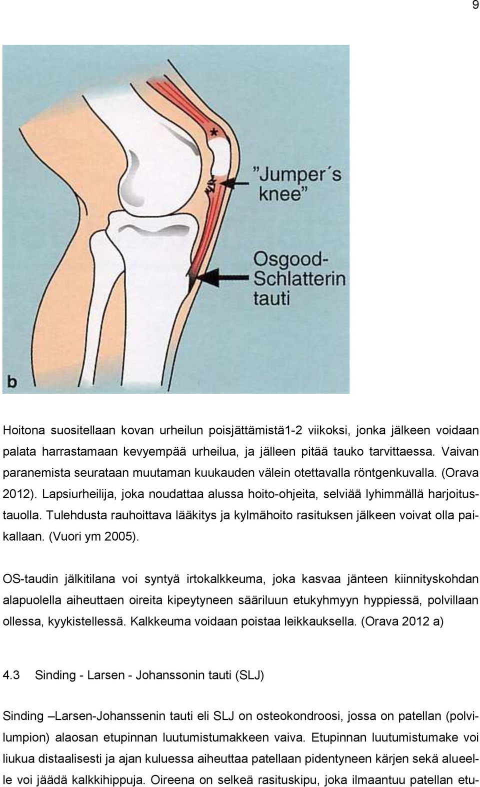 Tulehdusta rauhoittava lääkitys ja kylmähoito rasituksen jälkeen voivat olla paikallaan. (Vuori ym 2005).