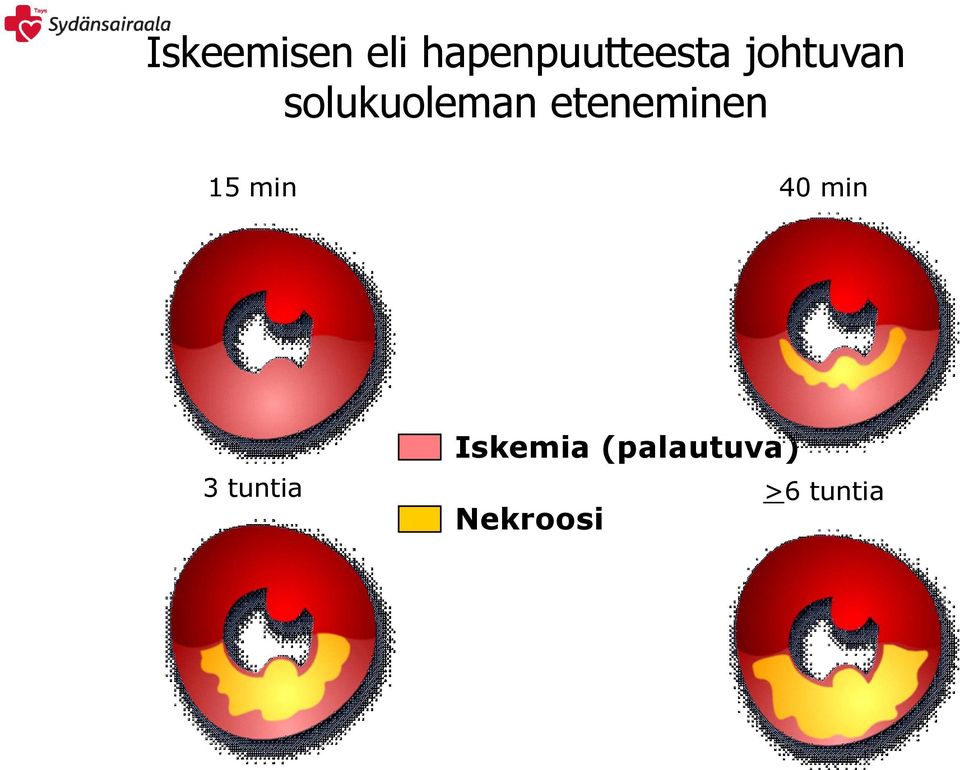 eteneminen 15 min 40 min