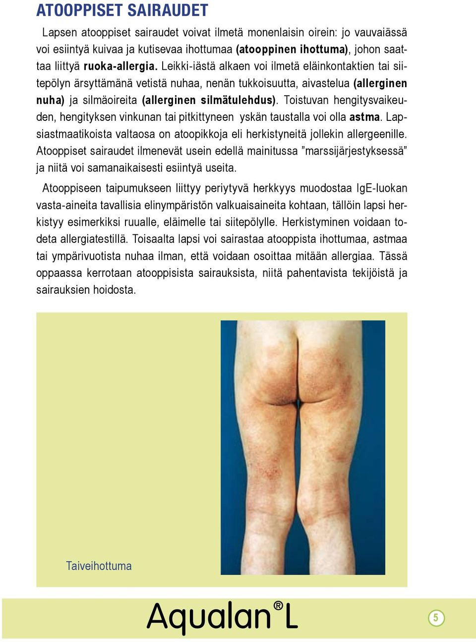 Toistuvan hengitysvaikeuden, hengityksen vinkunan tai pitkittyneen yskän taustalla voi olla astma. Lapsiastmaatikoista valtaosa on atoopikkoja eli herkistyneitä jollekin allergeenille.