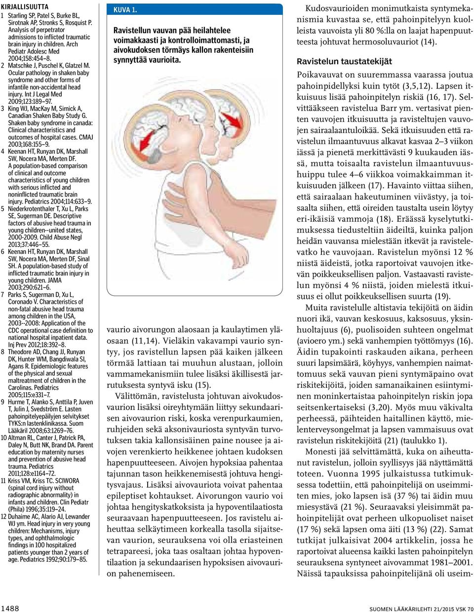 Int J Legal Med 2009;123:189 97. 3 King WJ, MacKay M, Sirnick A, Canadian Shaken Baby Study G. Shaken baby syndrome in canada: Clinical characteristics and outcomes of hospital cases.