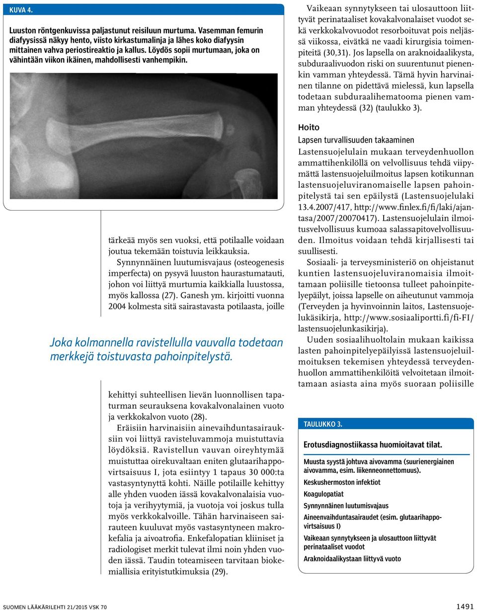 Synnynnäinen luutumisvajaus (osteogenesis imperfecta) on pysyvä luuston haurastumatauti, johon voi liittyä murtumia kaikkialla luustossa, myös kallossa (27). Ganesh ym.