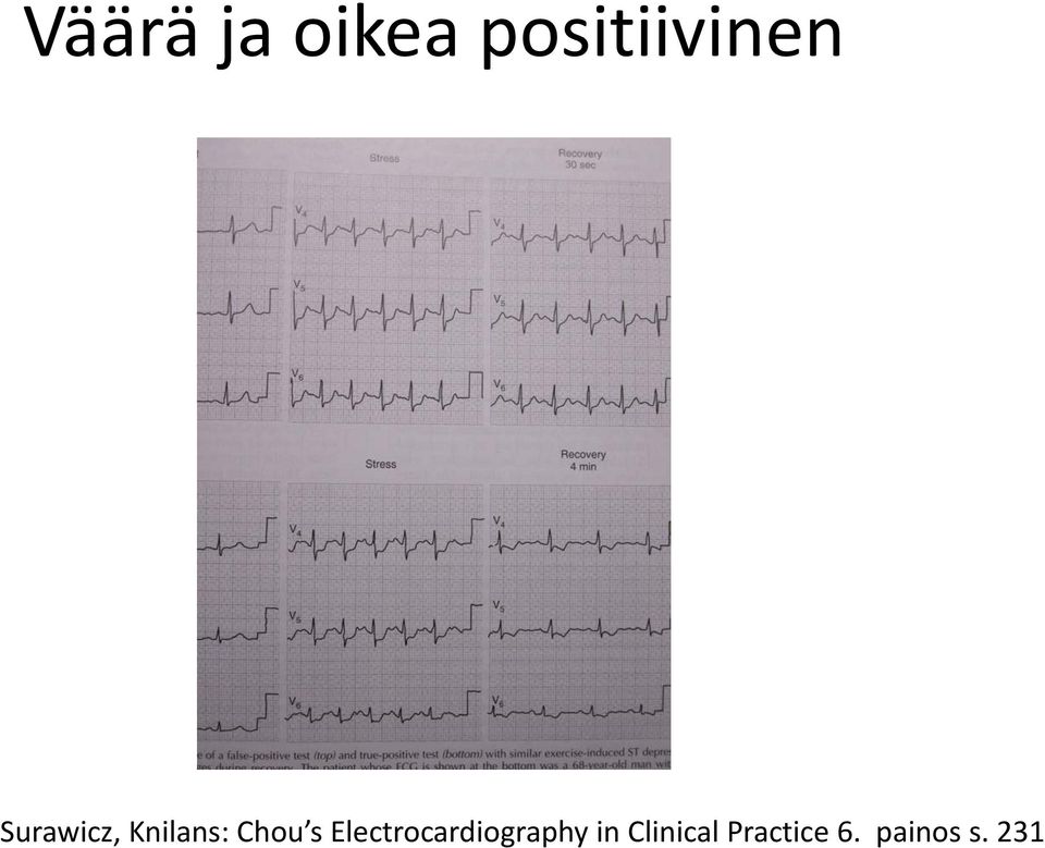 Electrocardiography in