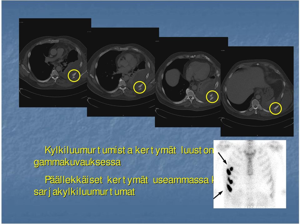 Päällekkäiset kertymät t