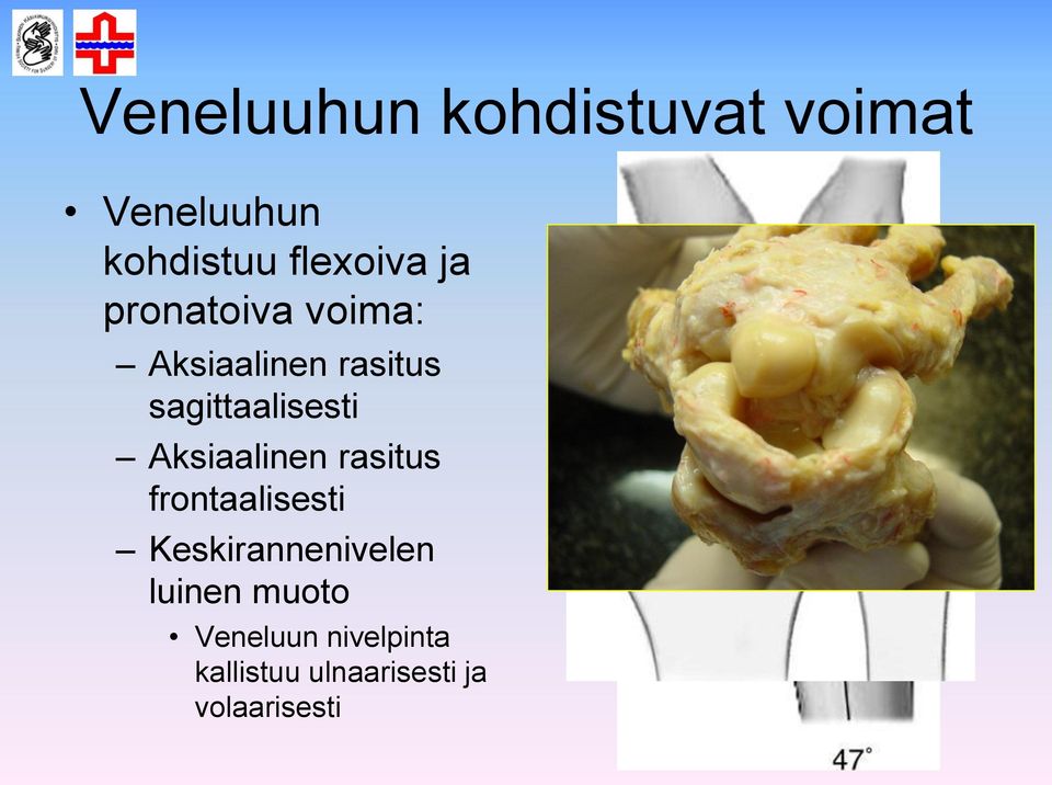 Aksiaalinen rasitus frontaalisesti Keskirannenivelen luinen