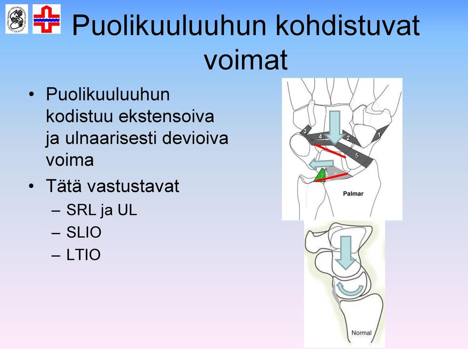 ekstensoiva ja ulnaarisesti