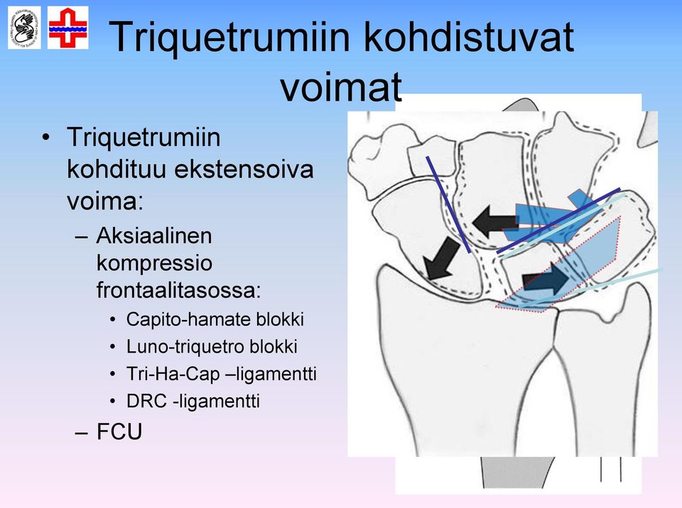 frontaalitasossa: FCU Capito-hamate blokki