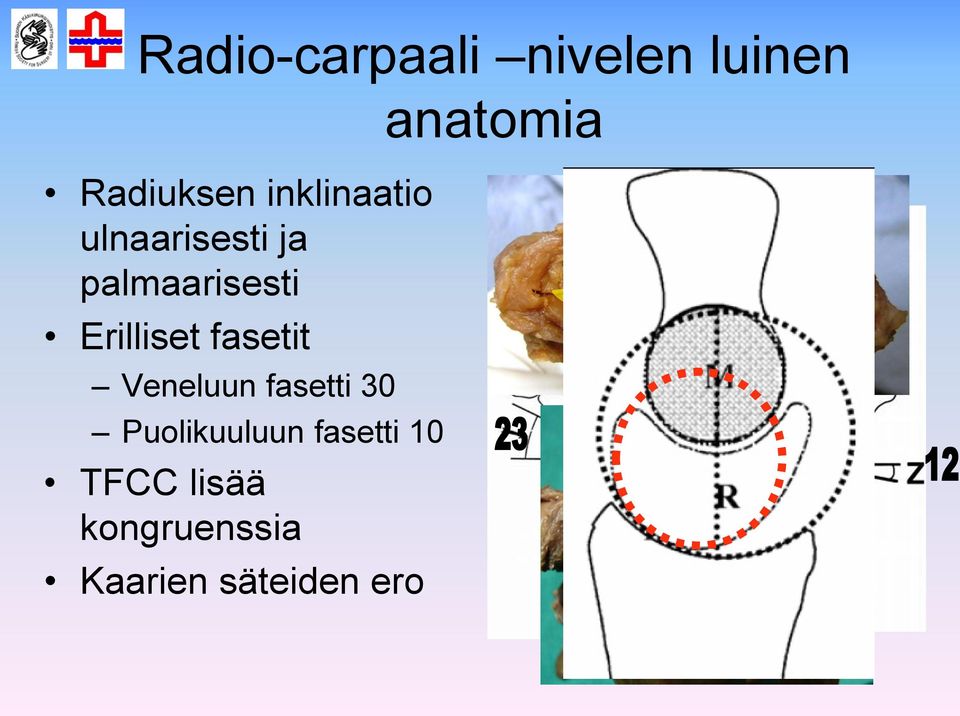 Erilliset fasetit Veneluun fasetti 30