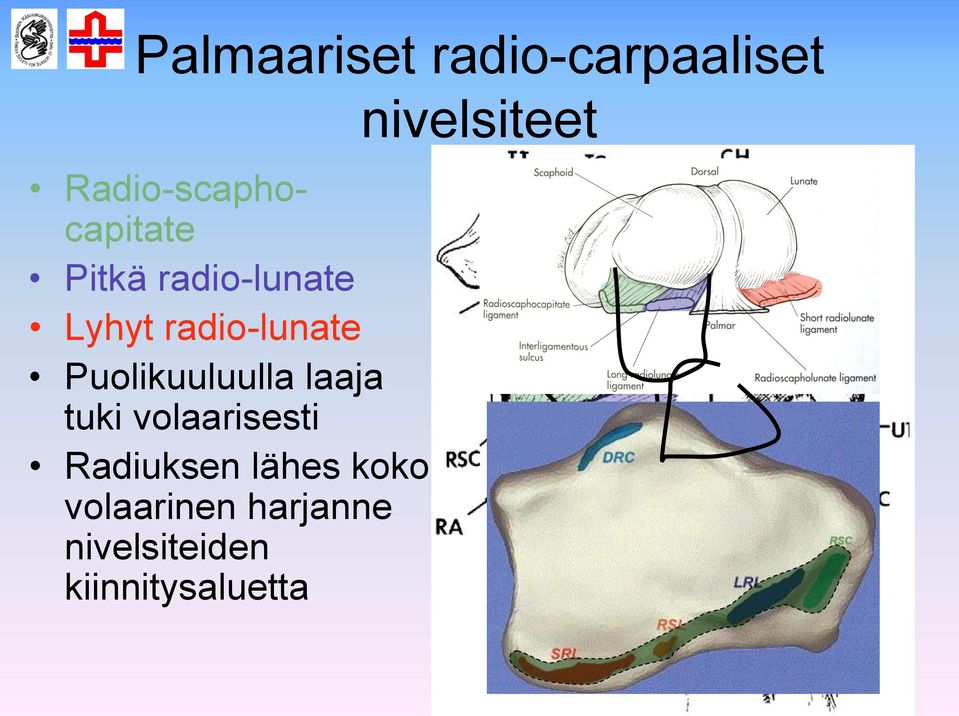 laaja tuki volaarisesti Radiuksen lähes koko