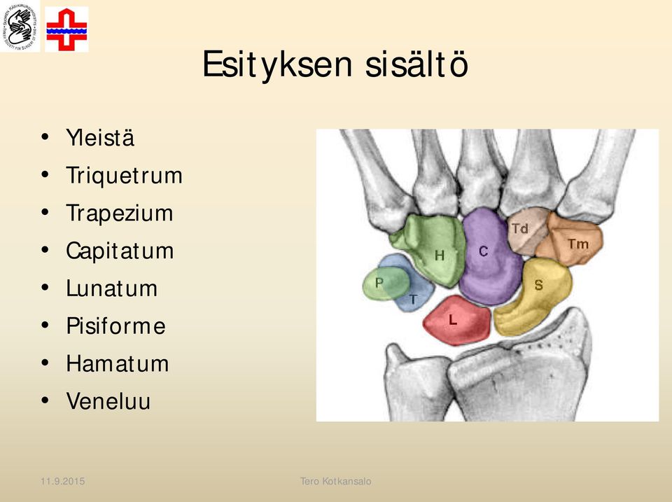 Trapezium Capitatum