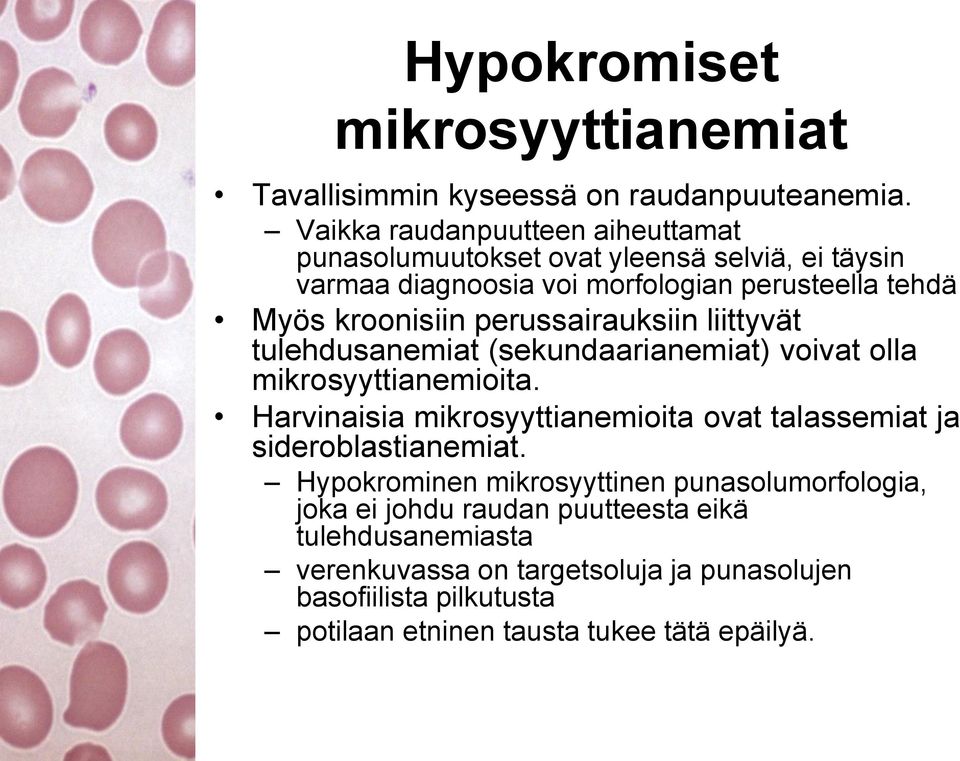 perussairauksiin liittyvät tulehdusanemiat (sekundaarianemiat) voivat olla mikrosyyttianemioita.