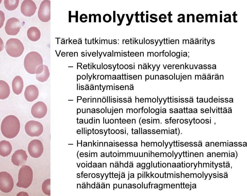 saattaa selvittää taudin luonteen (esim. sferosytoosi, elliptosytoosi, tallassemiat).