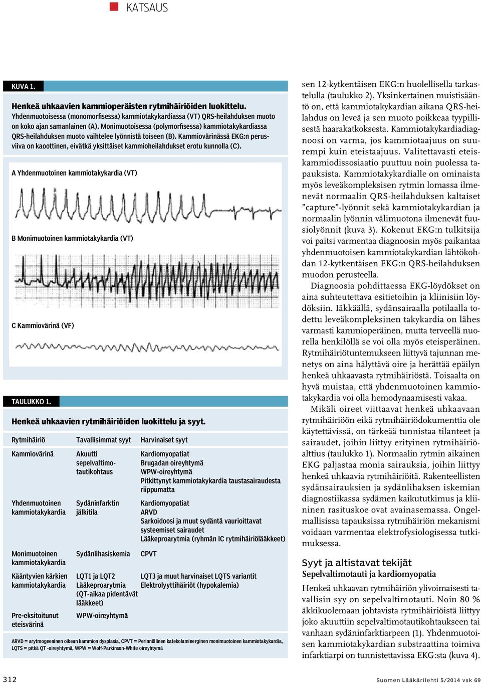 Kammiovärinässä EKG:n perusviiva on kaoottinen, eivätkä yksittäiset kammioheilahdukset erotu kunnolla (C).