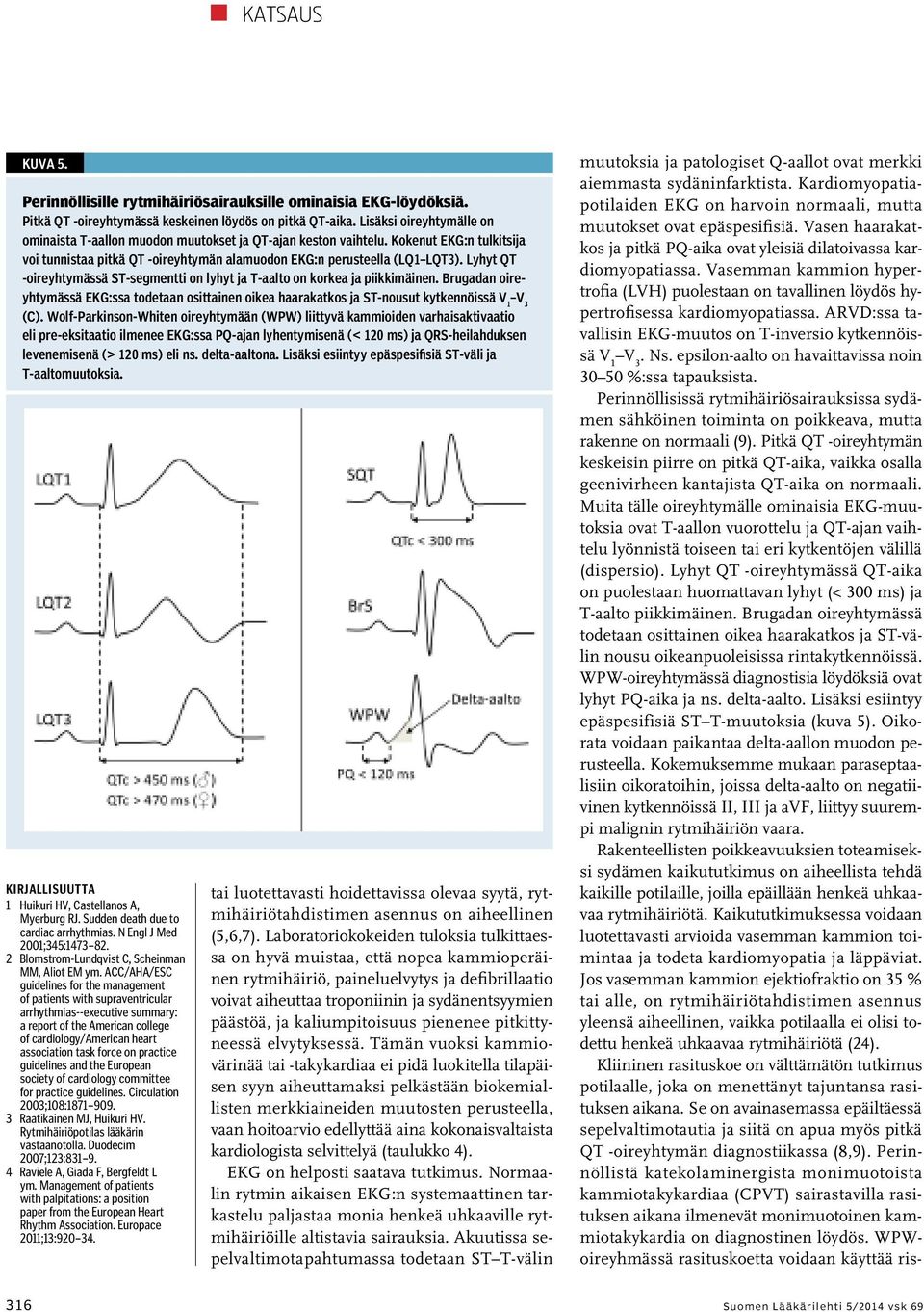 ARVD:ssa tavallisin EKG-muutos on T-inversio kytkennöissä V 1 V 3. Ns. epsilon-aalto on havaittavissa noin 30 50 %:ssa tapauksista.
