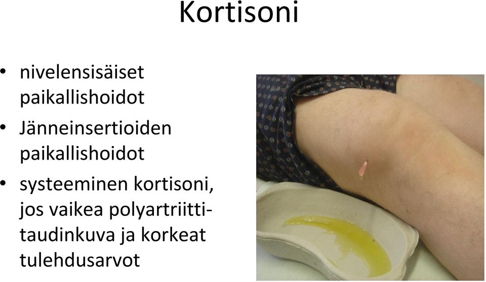 paikallishoidot systeeminen kortisoni,