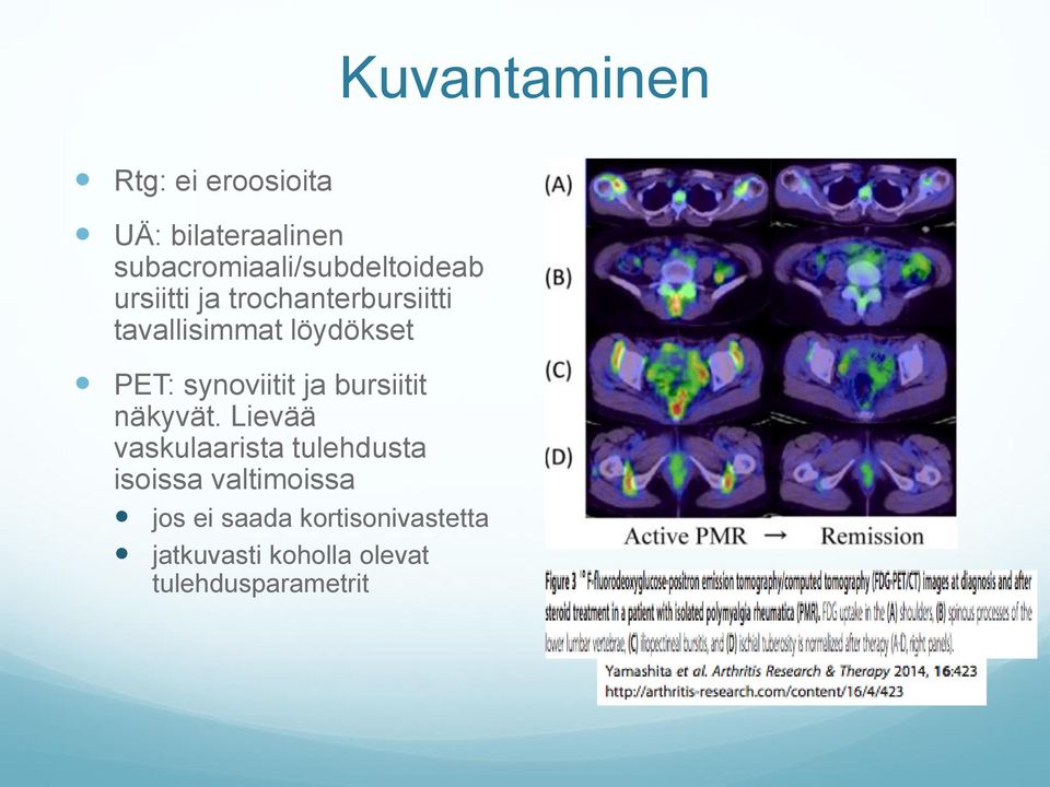 löydökset PET: synoviitit ja bursiitit näkyvät.