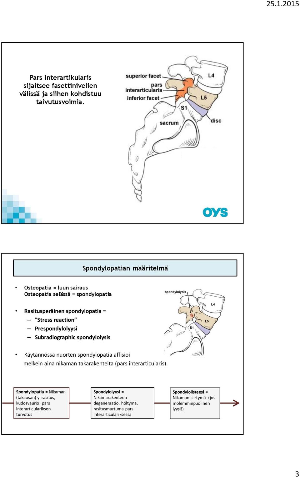 Subradiographic spondylolysis Käytännössä nuorten spondylopatia affisioi melkein aina nikaman takarakenteita (pars interarticularis).