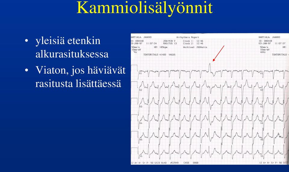 alkurasituksessa