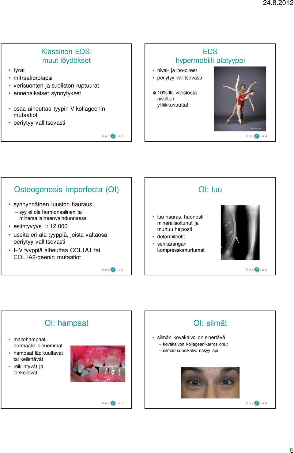 Osteogenesis imperfecta (OI) synnynnäinen luuston hauraus syy ei ole hormonaalinen tai mineraaliaineenvaihdunnassa esiintyvyys 1: 12 000 useita eri ala-tyyppiä, joista valtaosa periytyy vallitsevasti