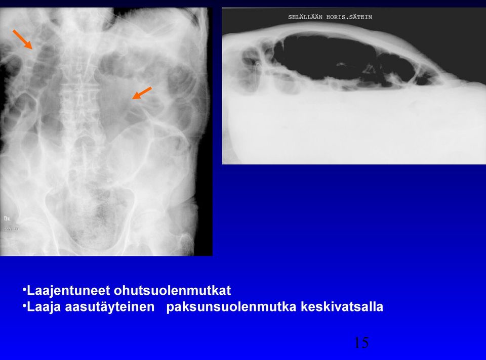 Laaja aasutäyteinen