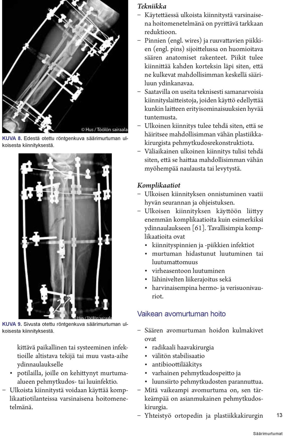 Piikit tulee kiinnittää kahden korteksin läpi siten, että ne kulkevat mahdollisimman keskellä sääriluun ydinkanavaa.