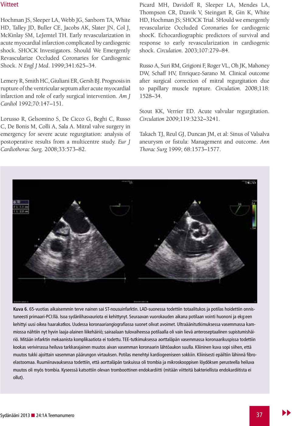 N Engl J Med. 1999;341:625 34. Lemery R, Smith HC, Giuliani ER, Gersh J. Prognosis in rupture of the ventricular septum after acute myocardial infarction and role of early surgical intervention.