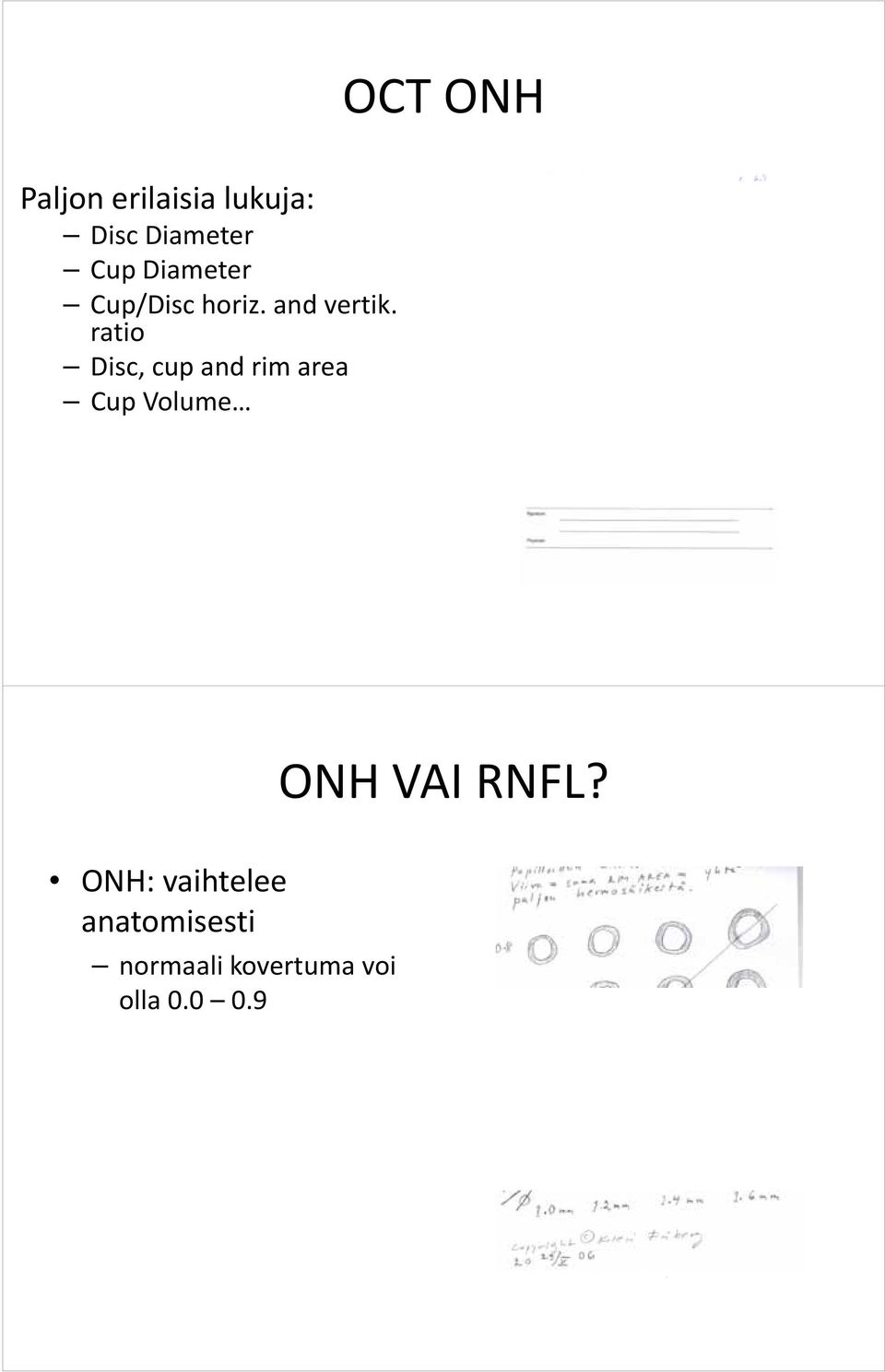 ratio Disc, cup and rim area Cup Volume OCT ONH