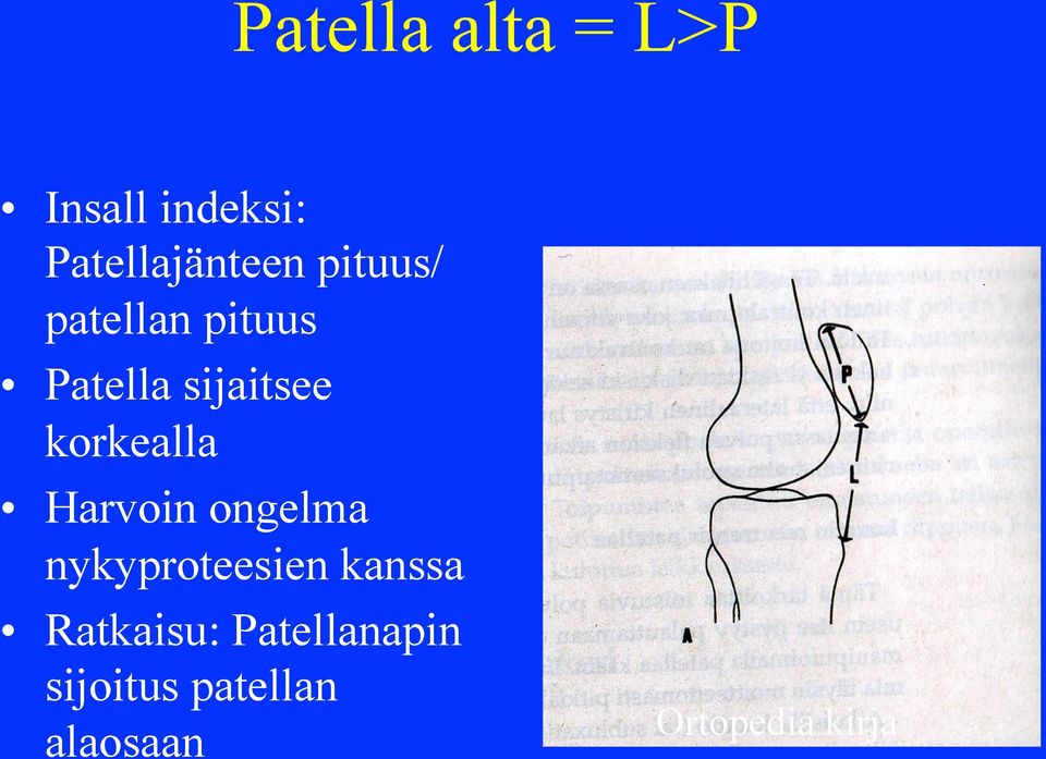 Harvoin ongelma nykyproteesien kanssa Ratkaisu: