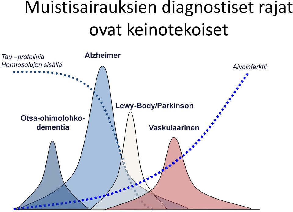 sisällä Alzheimer Aivoinfarktit