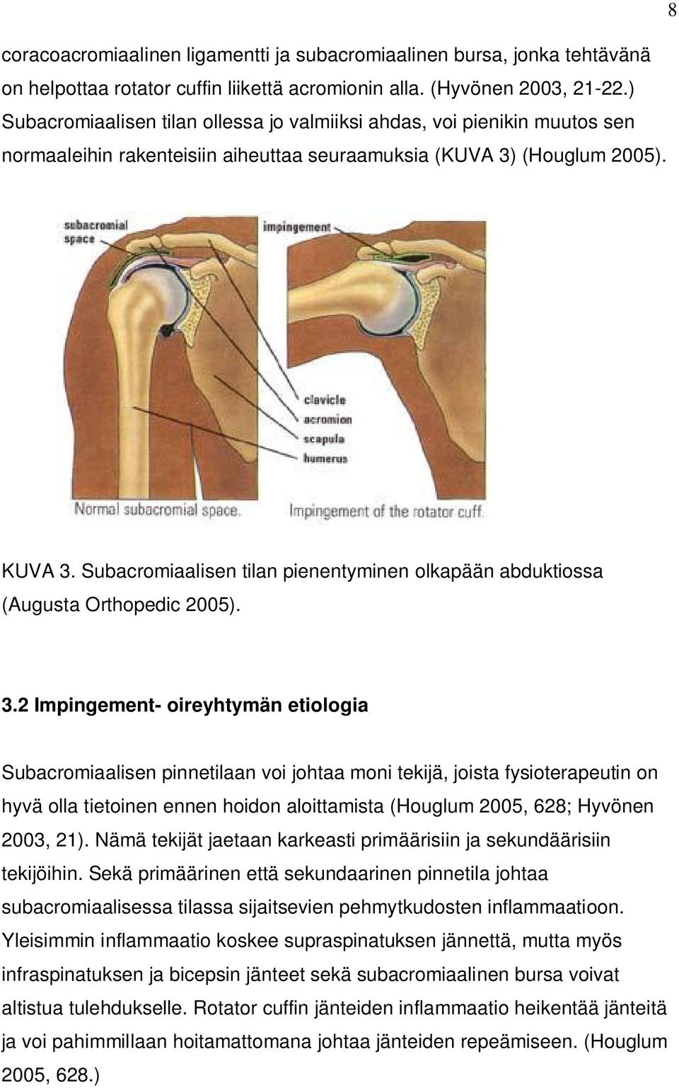 Subacromiaalisen tilan pienentyminen olkapään abduktiossa (Augusta Orthopedic 2005). 3.
