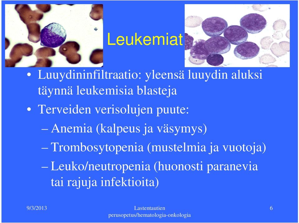 Anemia (kalpeus ja väsymys) Trombosytopenia (mustelmia ja