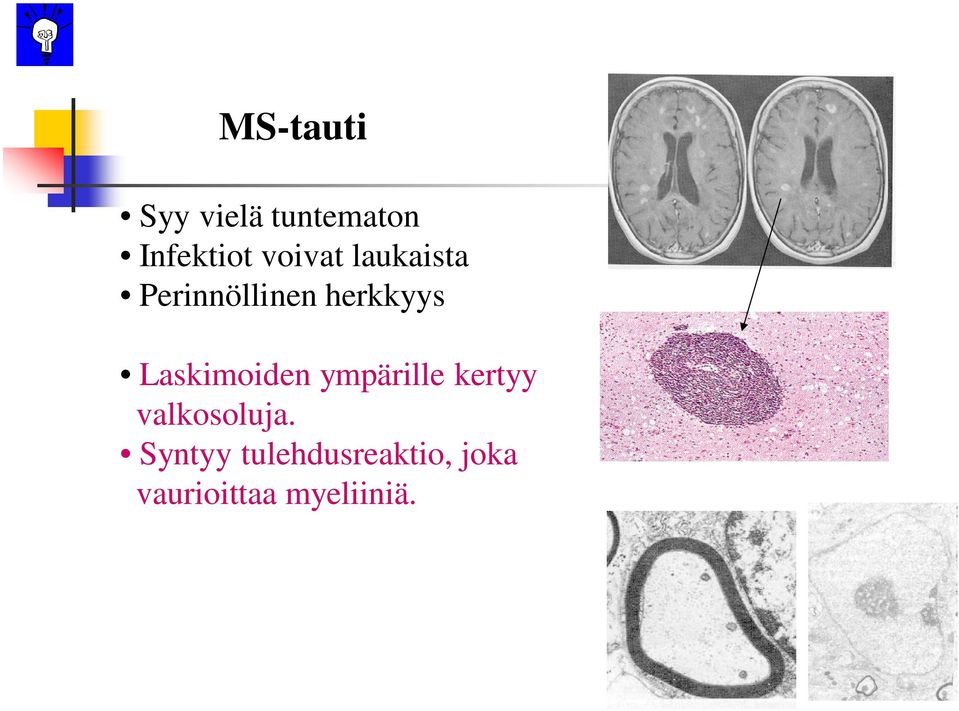 Laskimoiden ympärille kertyy valkosoluja.