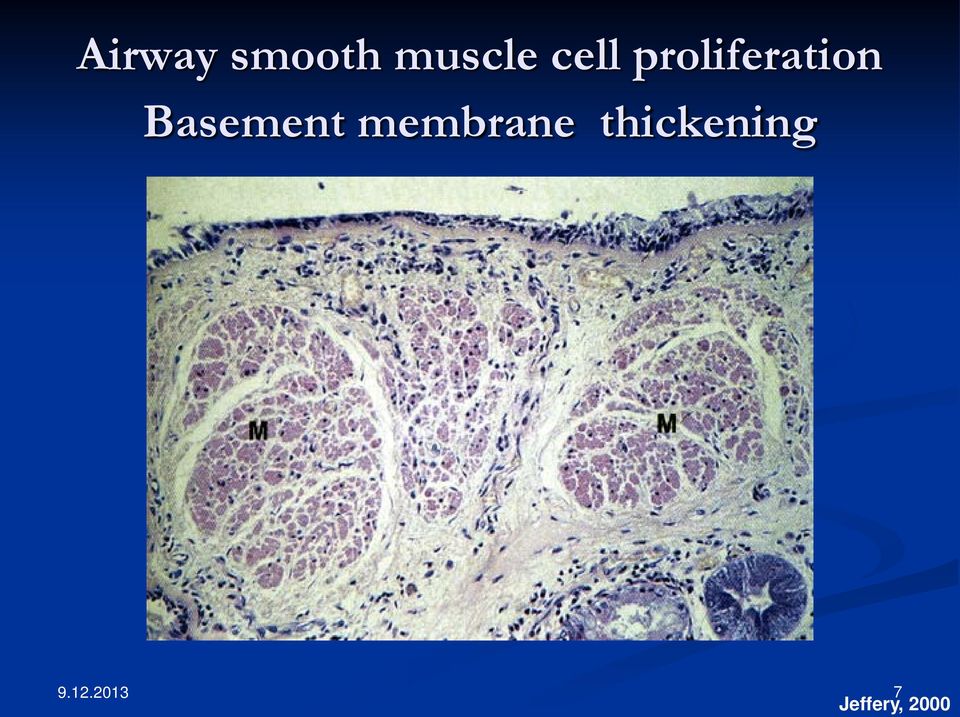 Basement membrane