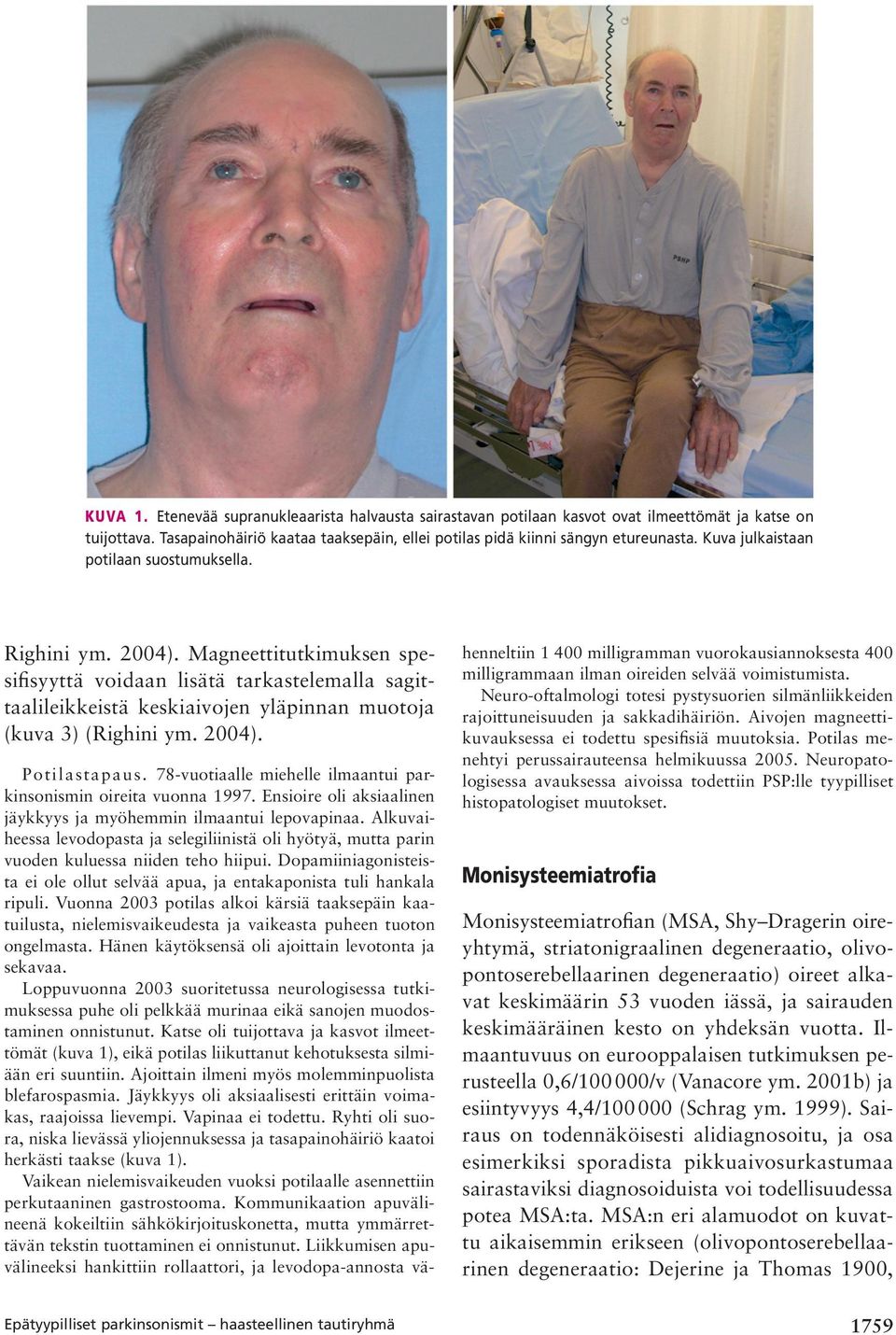 2004). Epätyypilliset parkinsonismit haasteellinen tautiryhmä Potilastapaus. 78-vuotiaalle miehelle ilmaantui parkinsonismin oireita vuonna 1997.