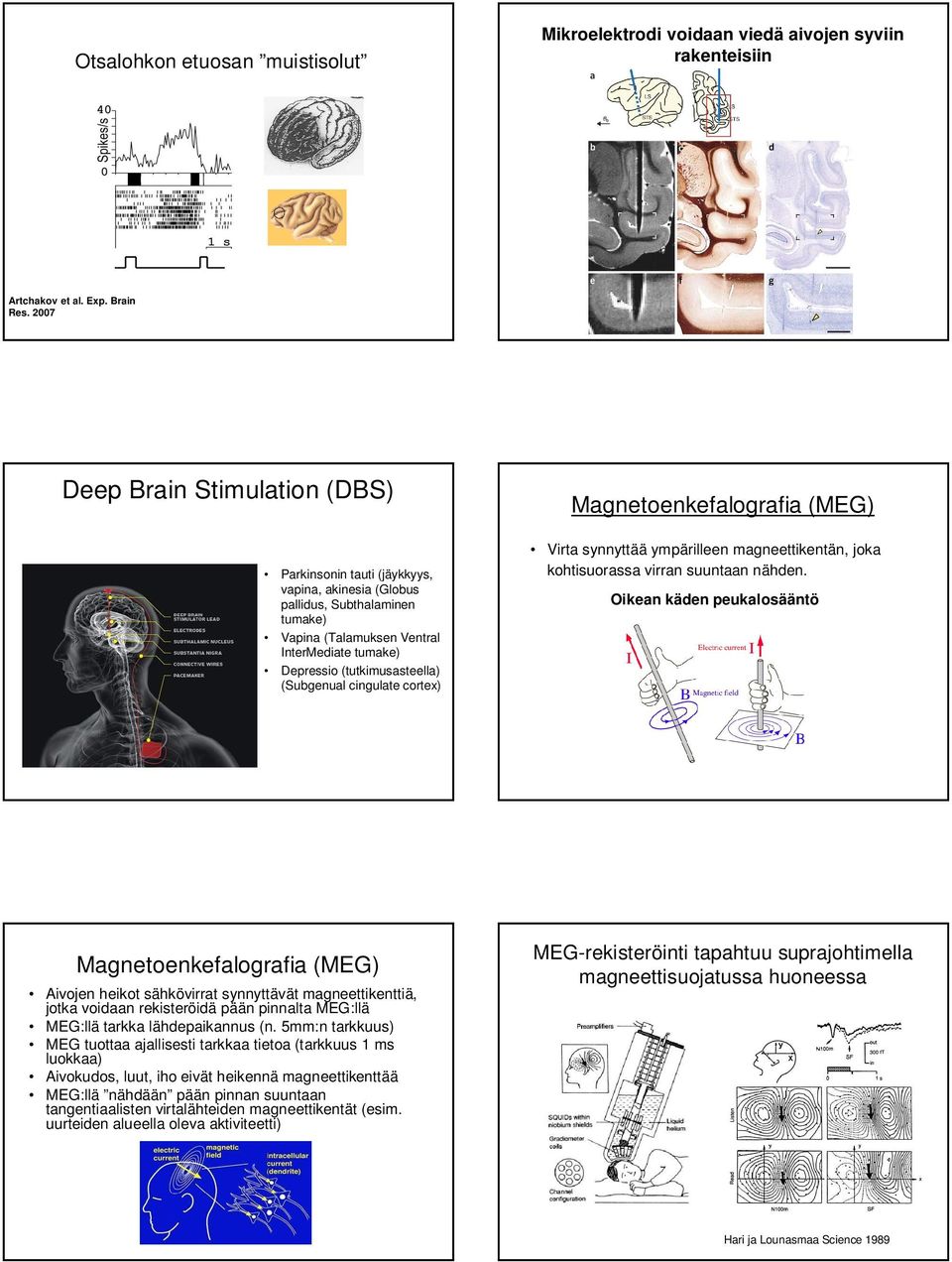 (Subgenual cingulate cortex) Magnetoenkefalografia (MEG) Virta synnyttää ympärilleen magneettikentän, joka kohtisuorassa virran suuntaan nähden.