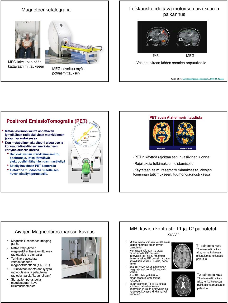 asp Positroni EmissioTomografia (PET) Mittaa laskimon kautta annettavan lyhytikäisen radioaktiivisen merkkiaineen jakaumaa kudoksessa Kun metabolinen aktiviteetti aivoalueella korkea, radioaktiivisen