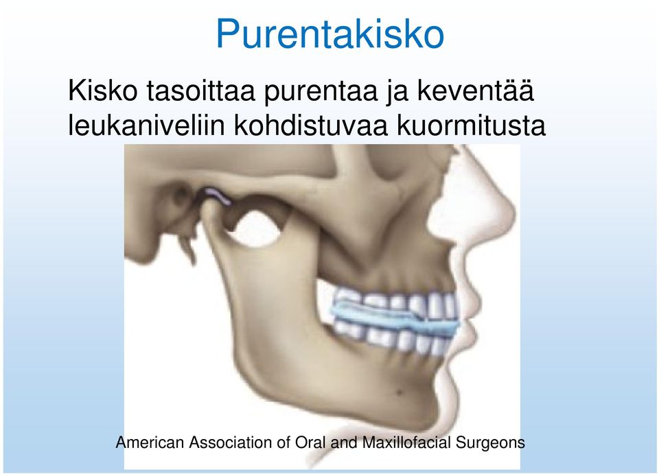 kohdistuvaa kuormitusta American