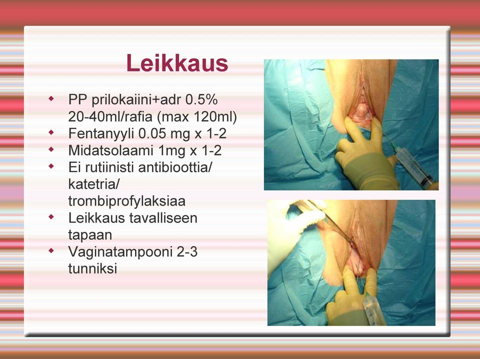 05 mg x 1-2 Midatsolaami 1mg x 1-2 Ei rutiinisti