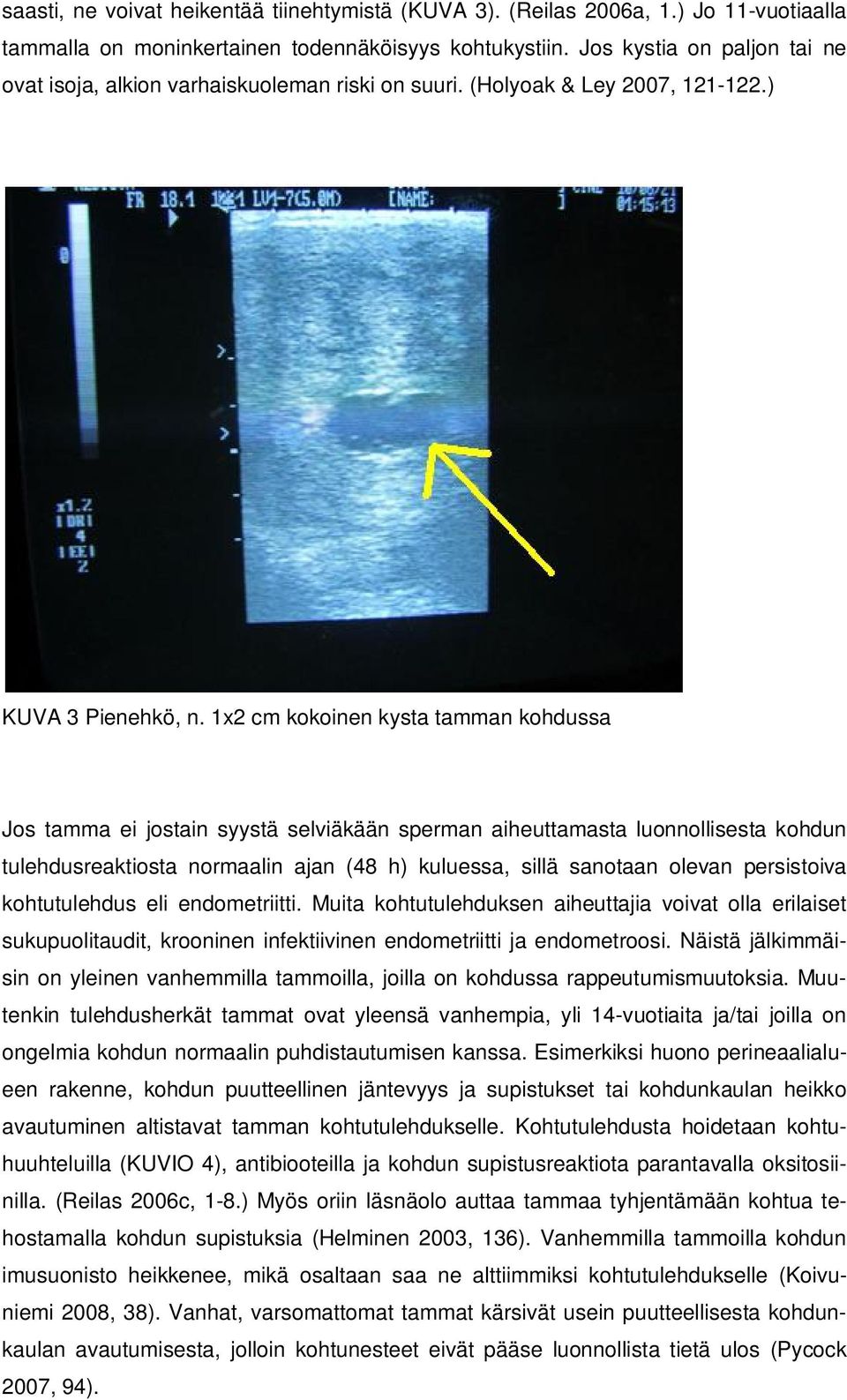 1x2 cm kokoinen kysta tamman kohdussa Jos tamma ei jostain syystä selviäkään sperman aiheuttamasta luonnollisesta kohdun tulehdusreaktiosta normaalin ajan (48 h) kuluessa, sillä sanotaan olevan