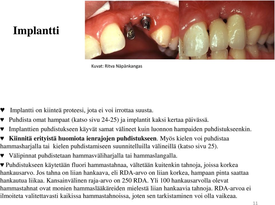 Myös kielen voi puhdistaa hammasharjalla tai kielen puhdistamiseen suunnitelluilla välineillä (katso sivu 25). Välipinnat puhdistetaan hammasväliharjalla tai hammaslangalla.