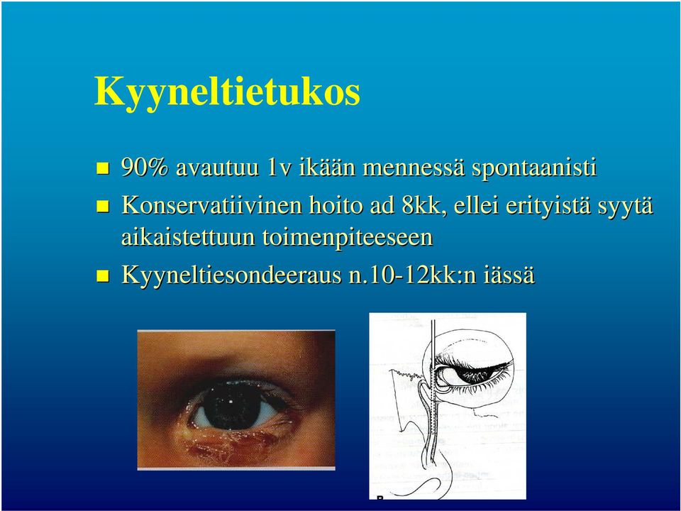 ellei erityistä syytä aikaistettuun