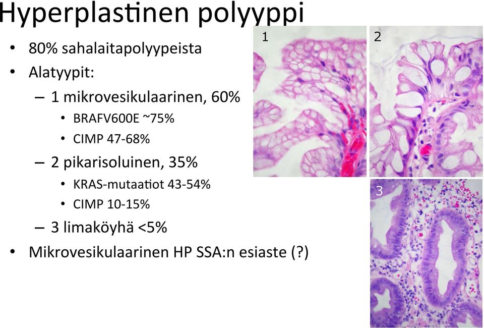 pikarisoluinen, 35% KRAS- mutaaeot 43-54% CIMP 10-15% 3