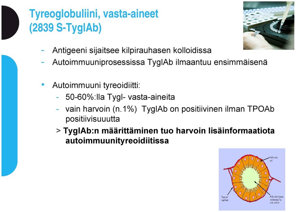 tyreoidiitti: - 50-60%:lla Tygl- vasta-aineita - vain harvoin (n.