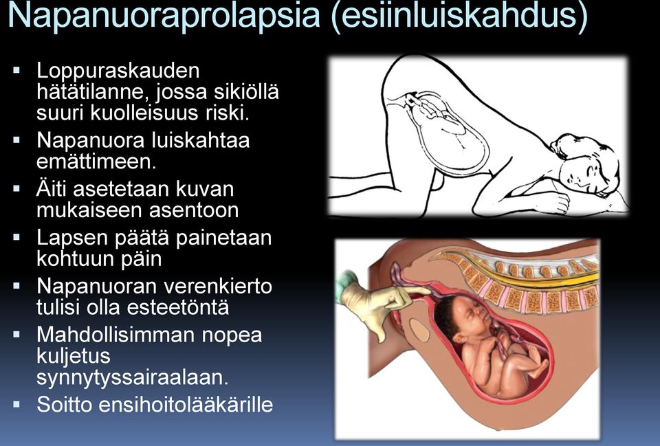 Äiti asetetaan kuvan mukaiseen asentoon Lapsen päätä painetaan kohtuun päin