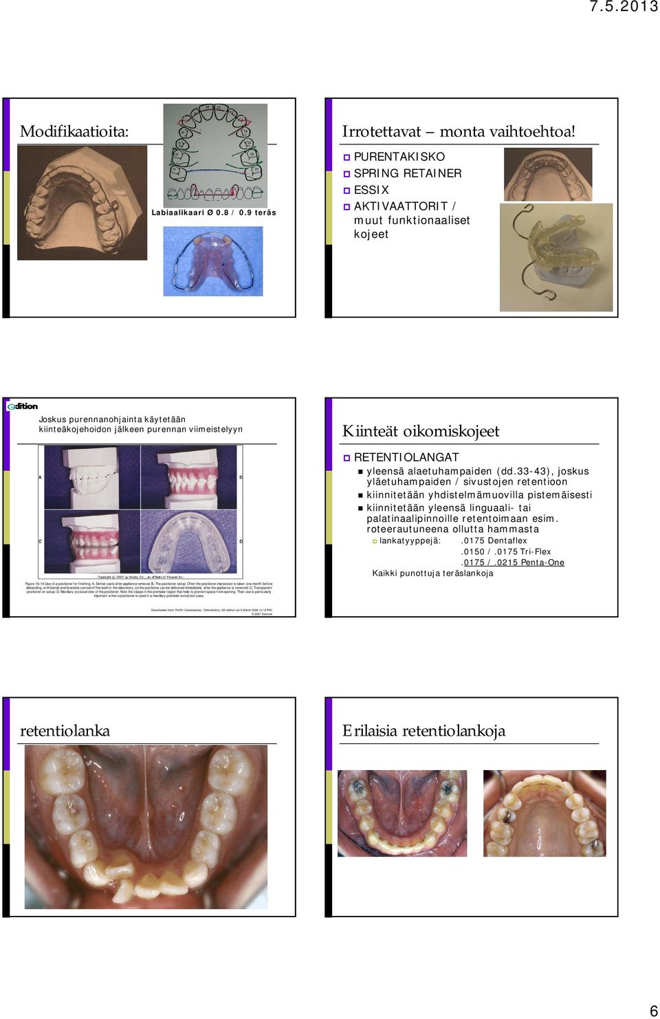 finishing. A, Dental casts after appliance removal; B, The positioner setup.