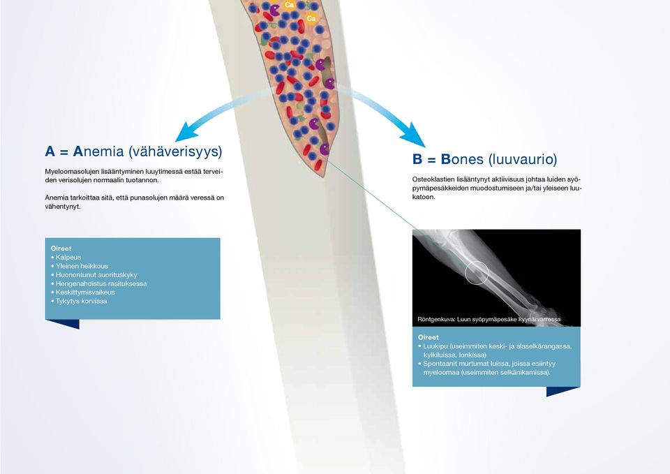 B = Bones (luuvaurio) Osteoklastien lisääntynyt aktiivisuus johtaa luiden syöpymäpesäkkeiden muodostumiseen ja/tai yleiseen luukatoon.