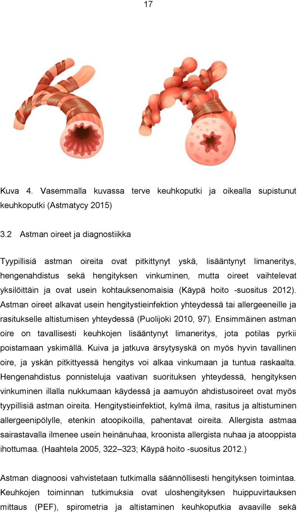 usein kohtauksenomaisia (Käypä hoito -suositus 2012). Astman oireet alkavat usein hengitystieinfektion yhteydessä tai allergeeneille ja rasitukselle altistumisen yhteydessä (Puolijoki 2010, 97).