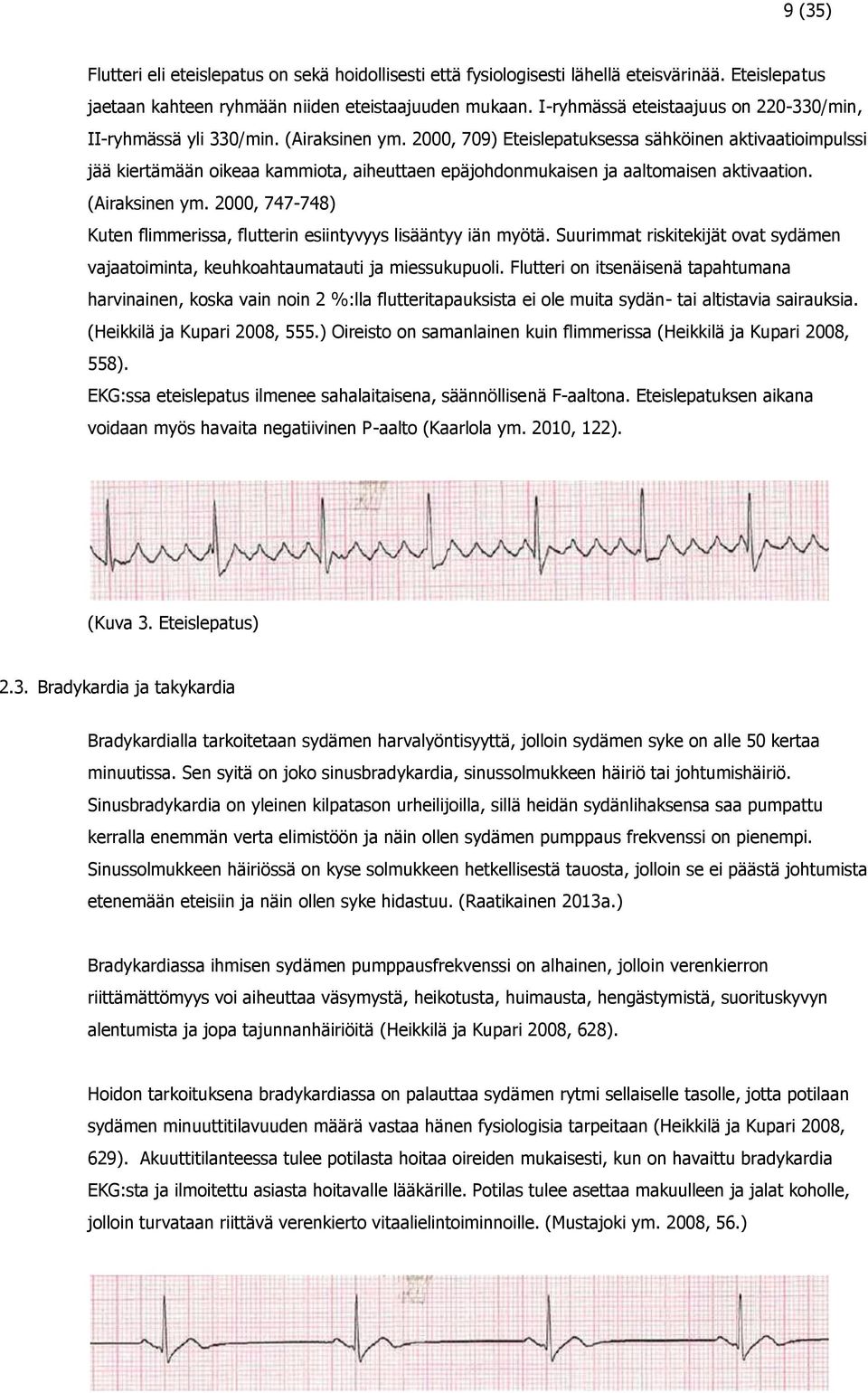 2000, 709) Eteislepatuksessa sähköinen aktivaatioimpulssi jää kiertämään oikeaa kammiota, aiheuttaen epäjohdonmukaisen ja aaltomaisen aktivaation. (Airaksinen ym.