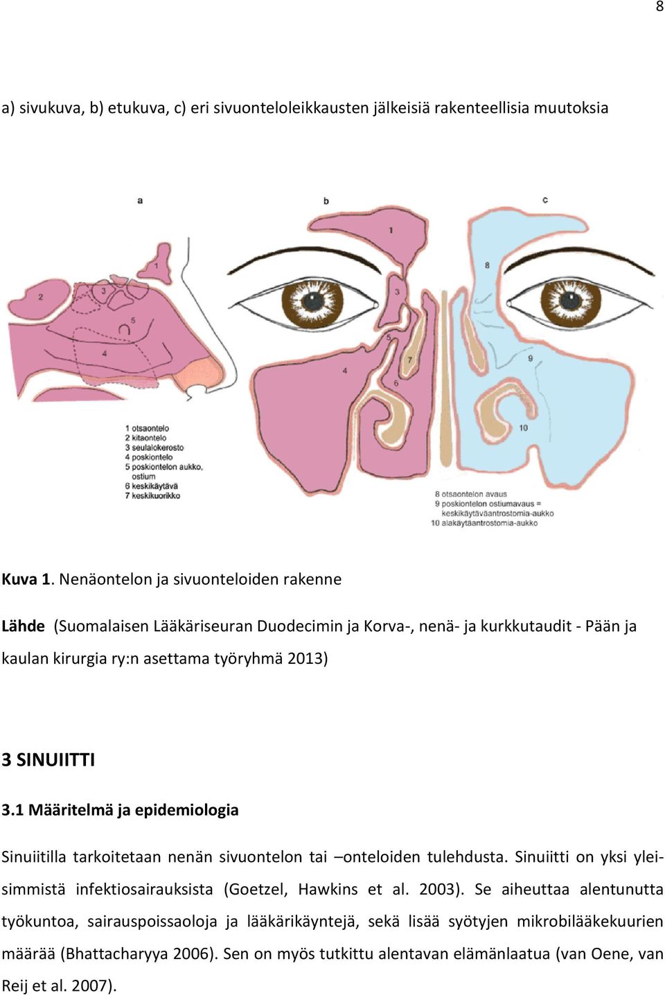 SINUIITTI 3.1 Määritelmä ja epidemiologia Sinuiitilla tarkoitetaan nenän sivuontelon tai onteloiden tulehdusta.
